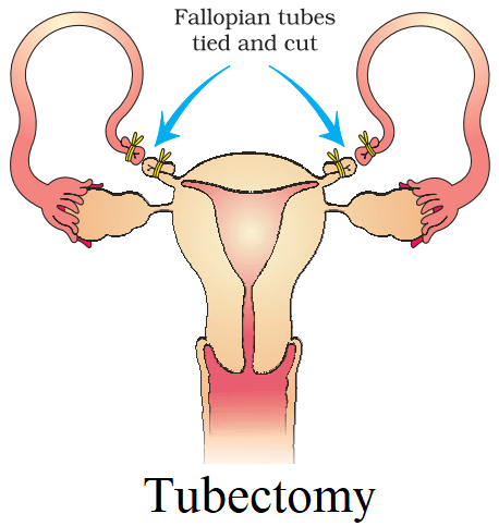 Class 12 Biology Chapter 4 Reproductive Health Question Answer